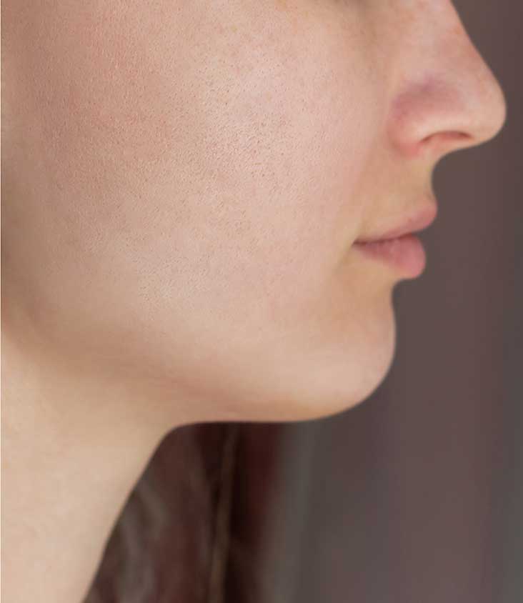 rash-after rash-after